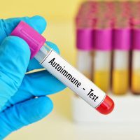 AutoimmuneTest AutoimmuneTest