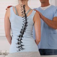 Spine3 Spine3